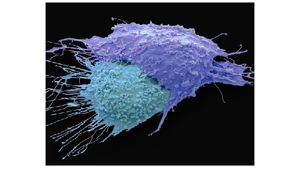 The Cancer-Industrial Complex: Biology, Medicine, and Business (Live Online)