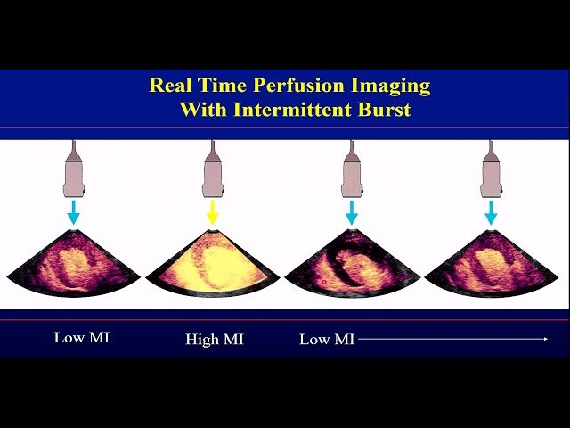 The Doppler Equation and Applications