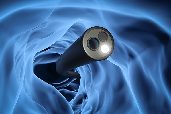 AI in Gastroenterology
