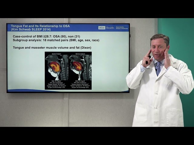 Surgical Evaluation and Treatment of Obstructive Sleep Apnea