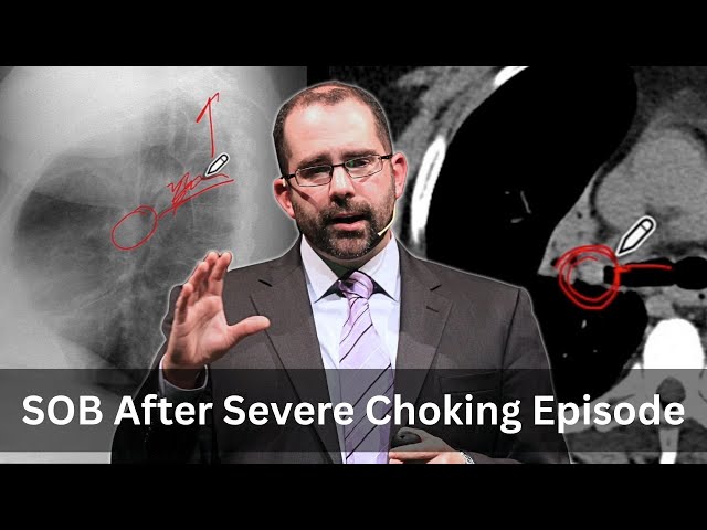 Like Peas in a Pod - EM Radiology Case of the Week