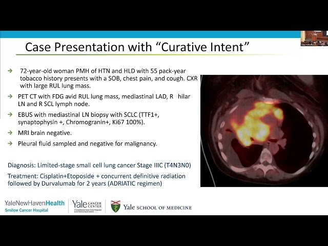 Small Cell Lung Cancer - Updates, Progress, and Promise of Targeted Therapy