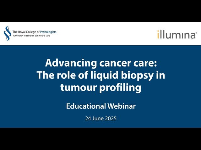 Advancing Cancer Care - The Role of Liquid Biopsy in Tumour Profiling