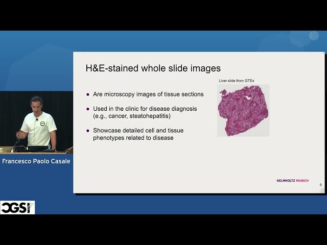 AI-Enabled Imaging Genetics and Causal Inference in Genetic Biobanks