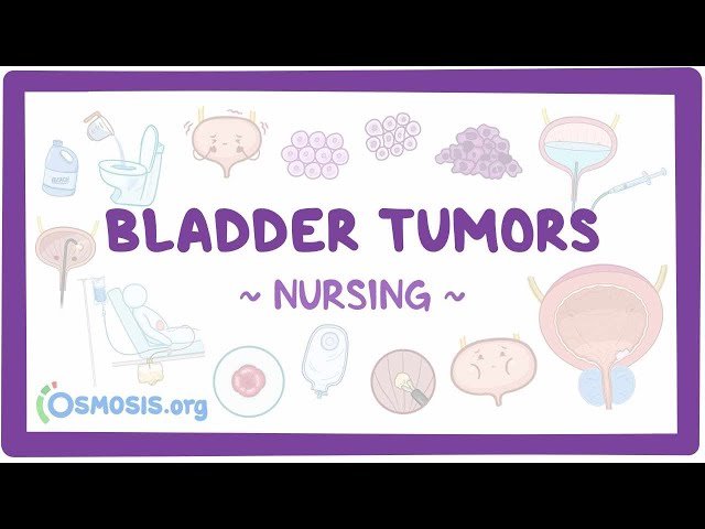 Bladder Tumors: Clinical Nursing Care