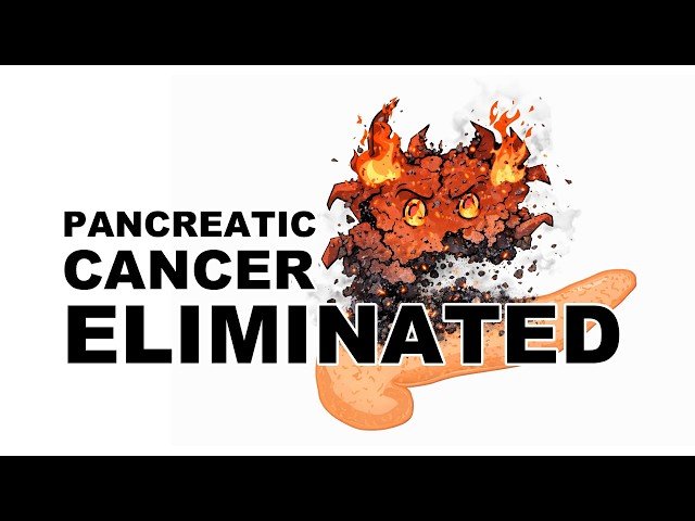 The Cancer That Always Comes Back - Until Now - Pancreatic Cancer Cured in Mice