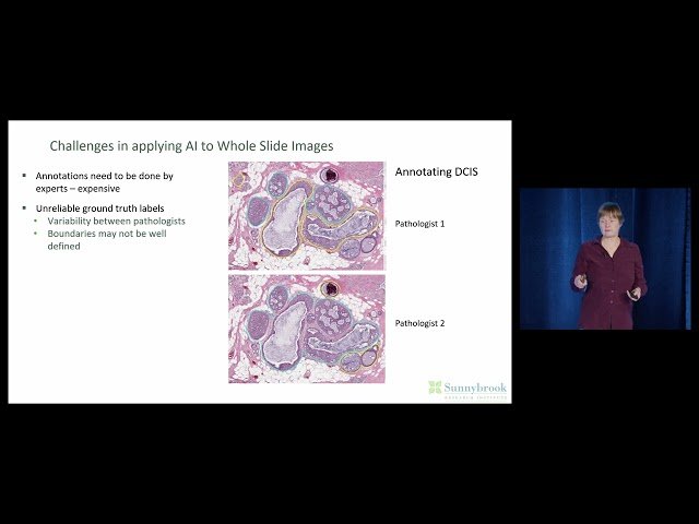 Artificial Intelligence and Digital Pathology: Making the Most of Limited Annotated Data