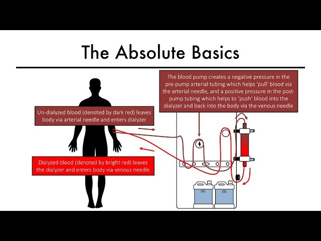 Hemodialysis Kinetics 101