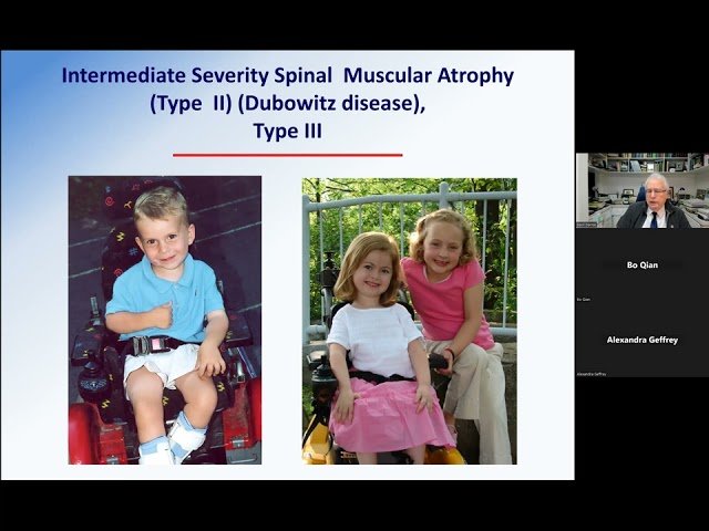 Spinal Muscular Atrophy Across the Year - January 18, 2024