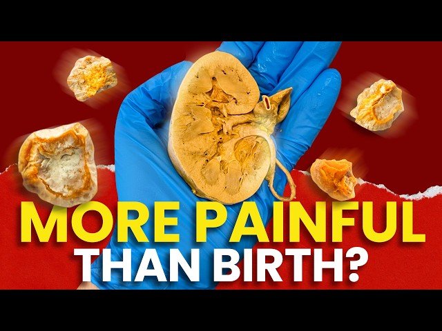 The Gritty Anatomy Inside Your Kidney