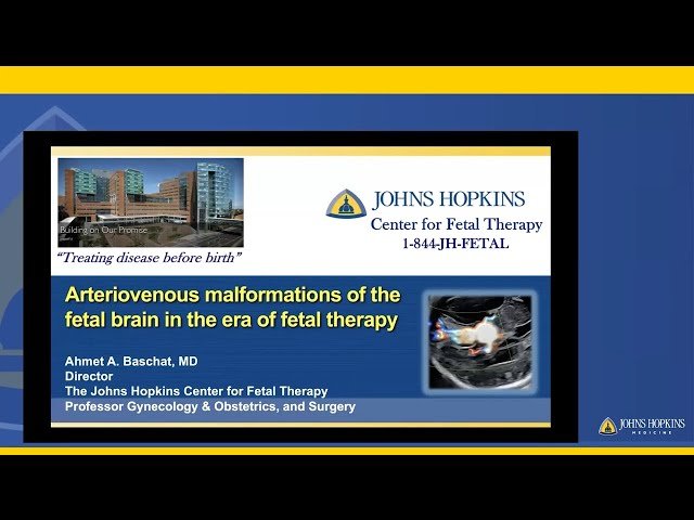 Vascular Abnormalities of the Fetal Brain - Fetal and Post-Natal Management and Treatment