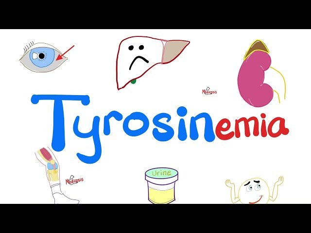 Tyrosinemia Types, Symptoms, Diagnosis and Treatment - An Overview of Metabolic Disorders