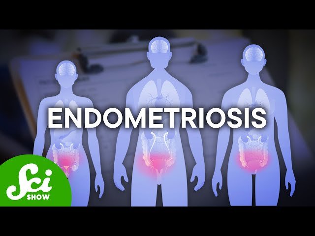 You Don't Need a Uterus to Get a Uterine Disease