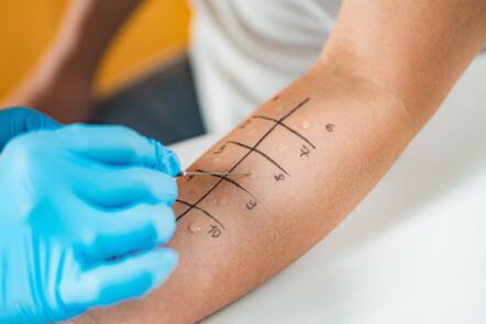 Understanding Penicillin Allergy Assessment and Delabelling