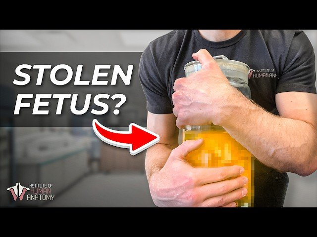 Someone Tried to Steal My Fetus - Anatomy Lab Security and Ethics