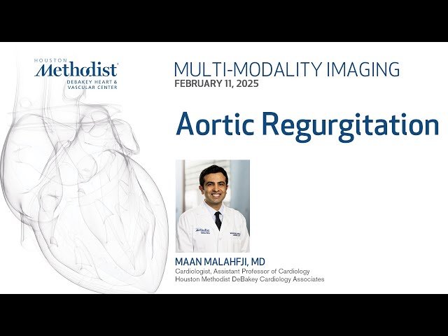 Aortic Regurgitation