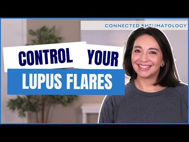 5 Essential Items to Control Lupus Flares at Home