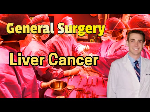 Liver Cancer - Medical Review Series - 2024 Update