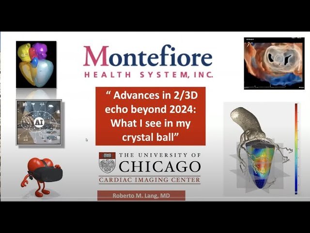 Advances in Echocardiography Beyond 2025: What I See in My Crystal Ball