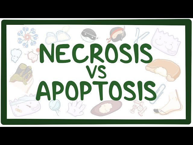 Necrosis and Apoptosis - Cell Death Mechanisms