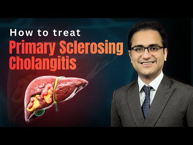 Primary Sclerosing Cholangitis - Treatment, Symptoms, Pathology, and Diagnosis