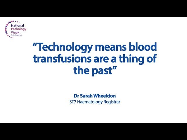 Technology and Blood Transfusions in Modern Pathology - Myths and Misconceptions