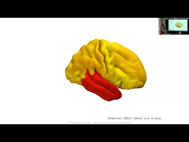 Bridging Scales with Brain Simulation - From Molecules to Disease Mechanisms