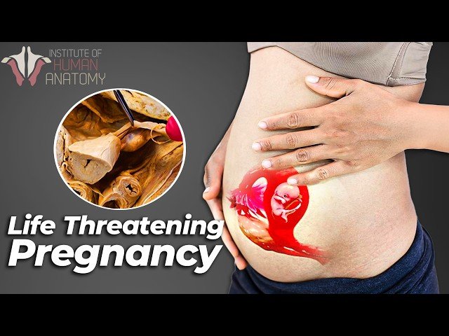 Understanding Ectopic Pregnancy: Causes, Risks, and Treatment