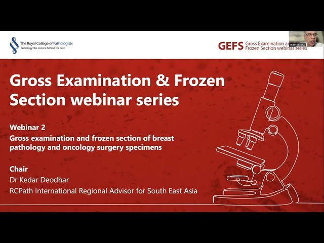 Gross Examination and Frozen Section of Breast Pathology and Oncology Surgery Specimens