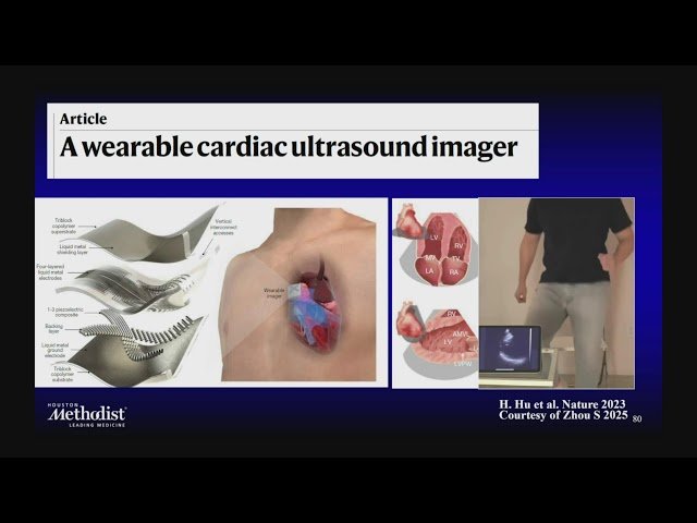 Basics of Echocardiography - Physics