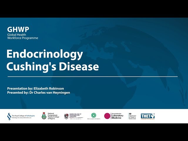 Endocrinology - Cushing's Disease