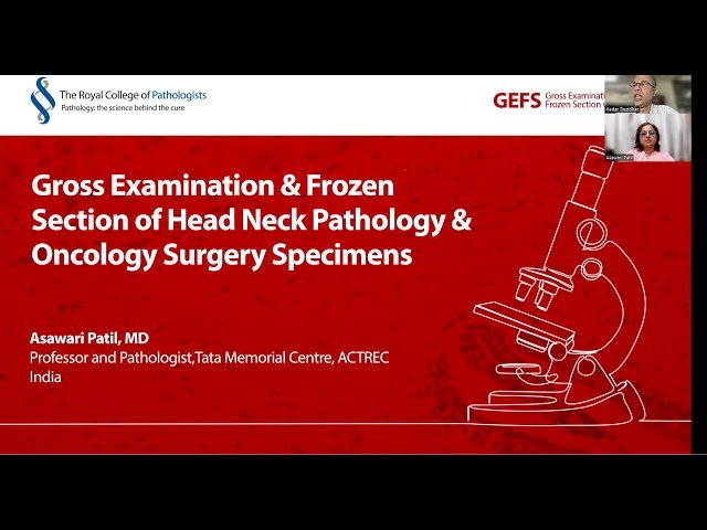 Gross Examination and Frozen Section of Head and Neck Pathology and Oncology Surgery Specimens
