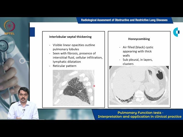 Radiological Assessment of Obstructive and Restrictive Lung Disorders