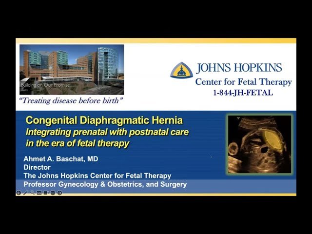 Management Advances for Congenital Diaphragmatic Hernia - Integrating Fetal and Postnatal Care