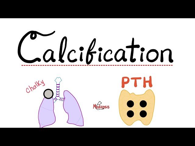 Dystrophic Calcification vs. Metastatic Calcification - Pathological Calcification Types