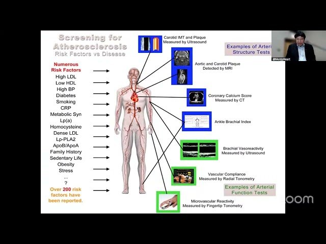 Coronary Calcium - Evolution, Role in Preventive Cardiology and Opportunistic Testing