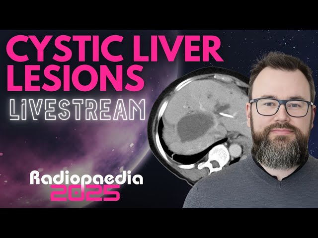 Cystic Liver Lesions