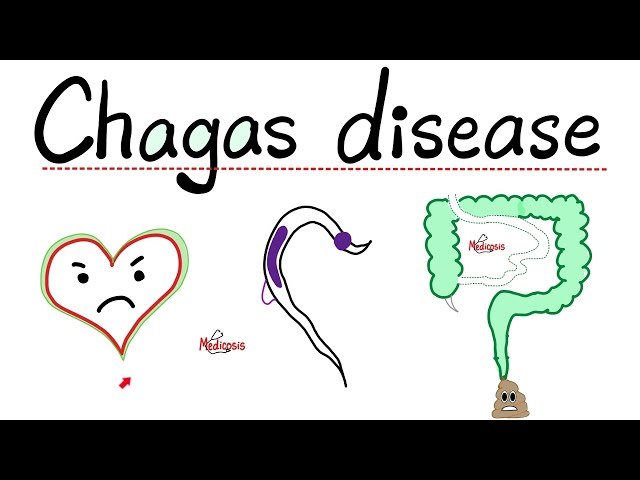 Chagas Disease: Understanding American Trypanosomiasis and Trypanosoma Cruzi
