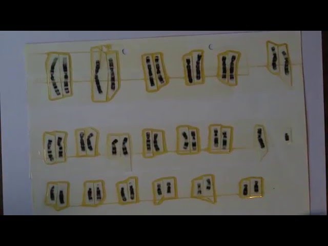 Introduction to Human Genetics and Inheritance