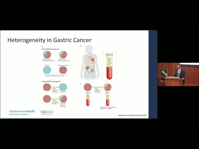 Charting Gastric Cancer Evolution through Tumor Ecosystems and Metastatic Pathways