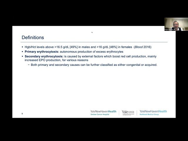 Benign Hematology and Elevated Blood Counts