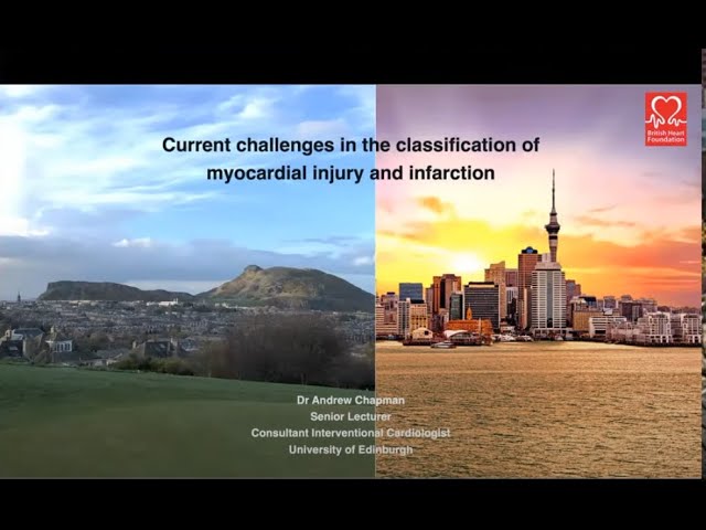 Type 2 Myocardial Infarction: Challenges in Diagnosis and Treatment