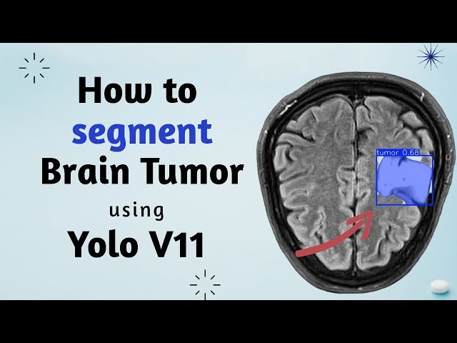 Detect and Segment Brain Tumors with YOLOv11