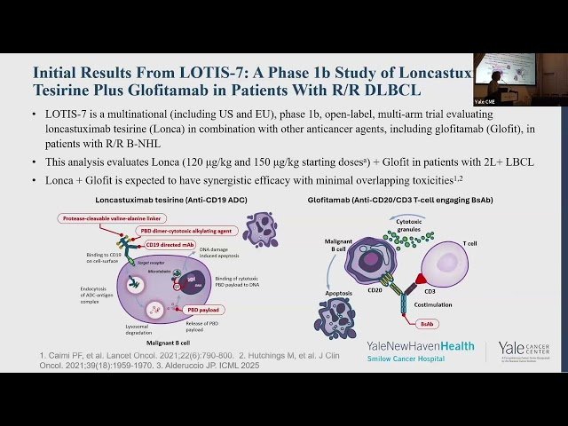 B Cell Lymphoma - Review of Advances in Oncology from the 2025 ASCO Annual Meeting