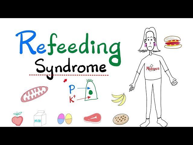 Refeeding Syndrome - Eating Disorders