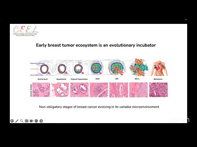 Ecology and Evolution of Breast Carcinogenesis