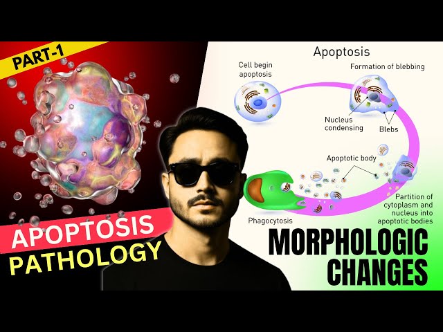 Apoptosis Pathology - Cases and Morphologic Changes in General Pathology