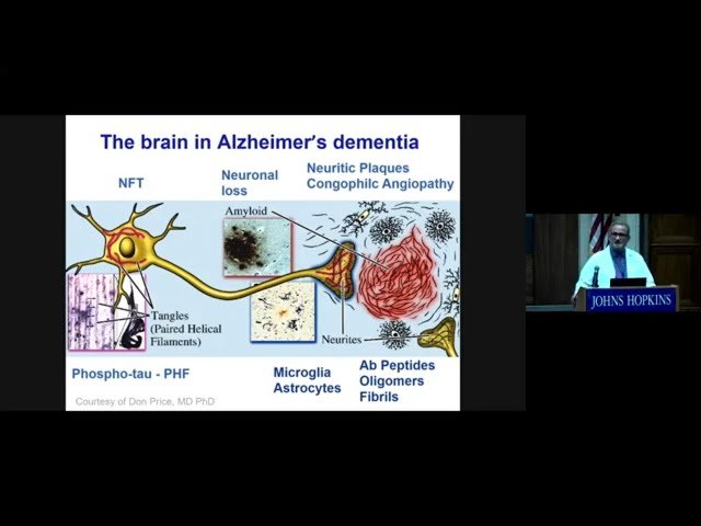 Three Hot Topics in Alzheimer's Disease