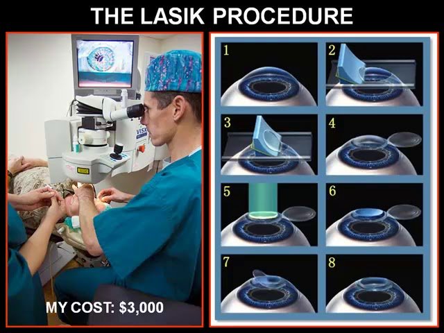 Eye Surgery and the Fossil Preparator - Personal Perspectives