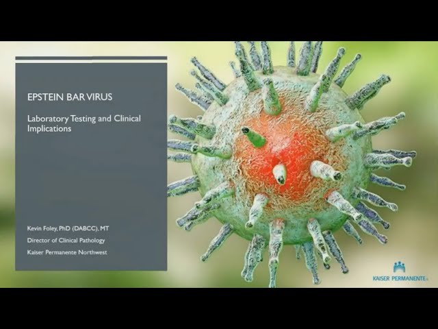 EBV Testing - A Laboratory Perspective